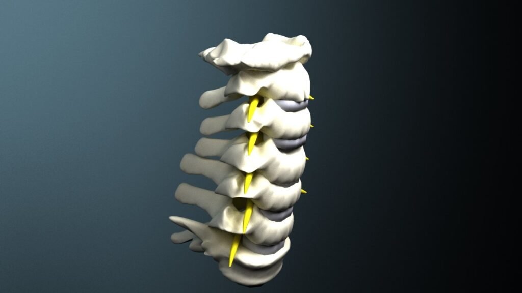 Spinal Lumbar Fusion structure