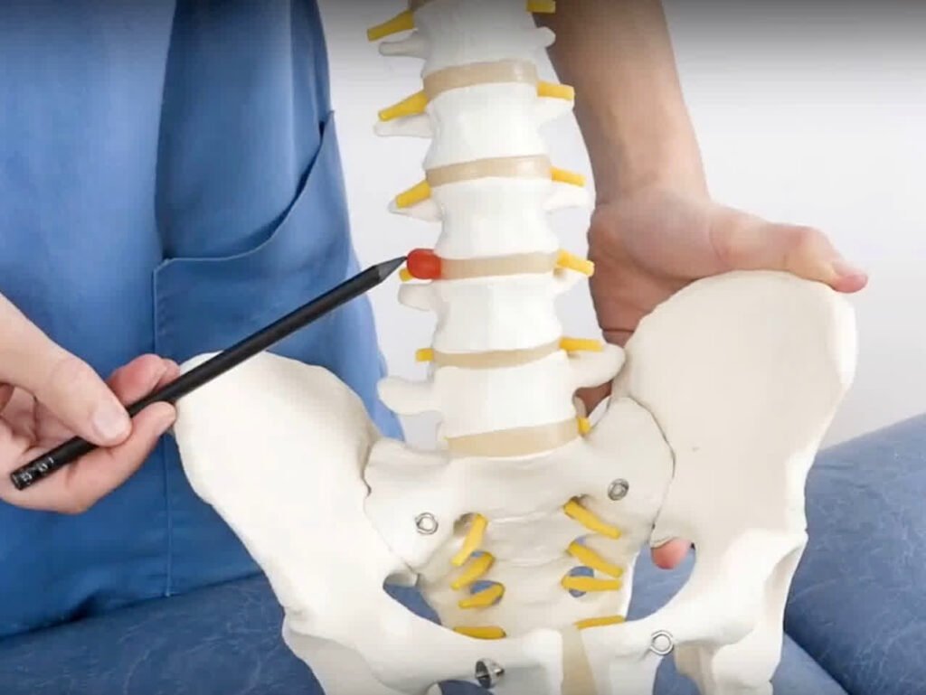 Herniated Disc Treatment