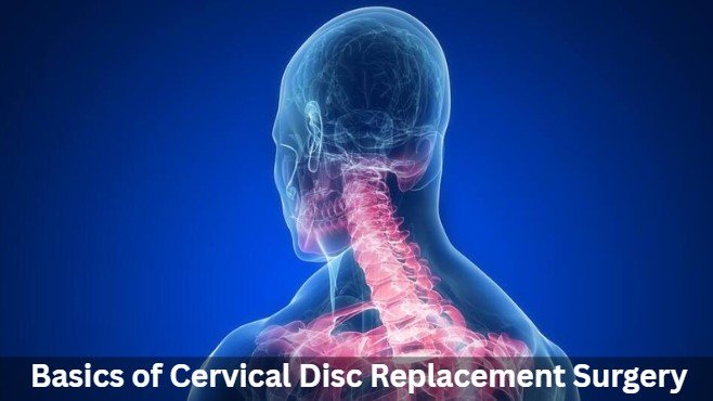 cervical disc-replacement-surgery-success-rate